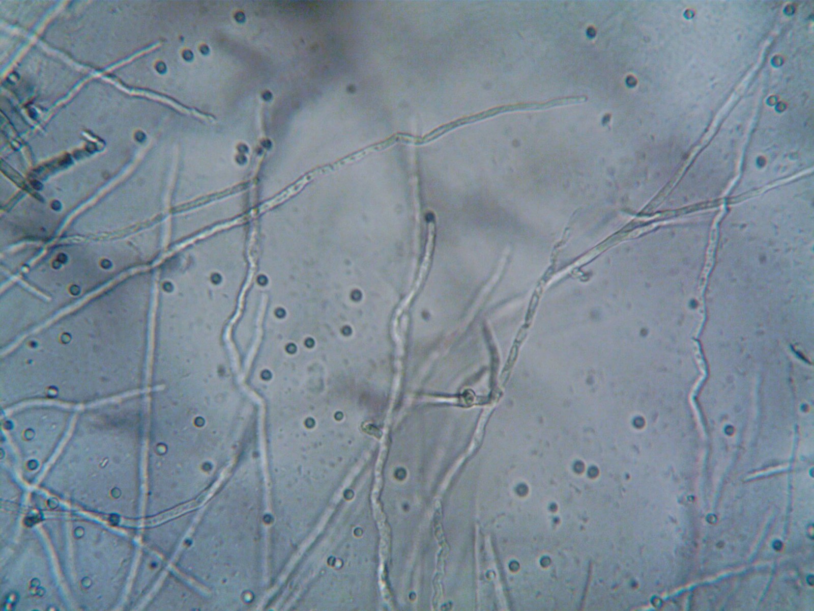 Filaments blancs de mycélium de champignon de Paris visibles dans le substrat